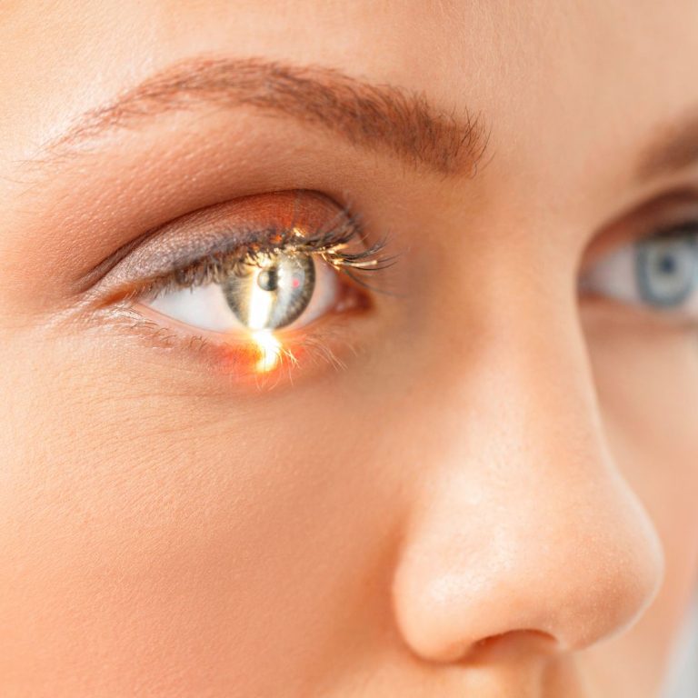 Optometría en Alicante 4 Optometría en Alicante 3